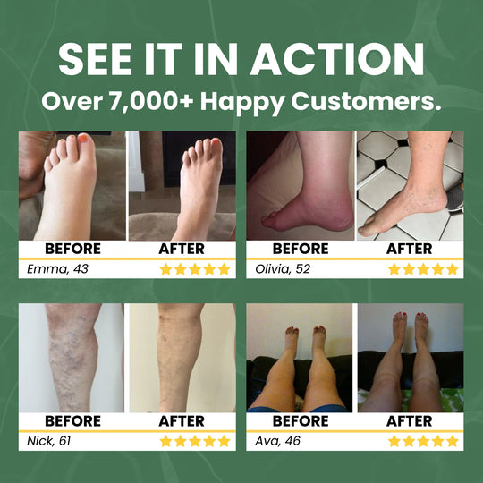 Sorviq Miracle Balm